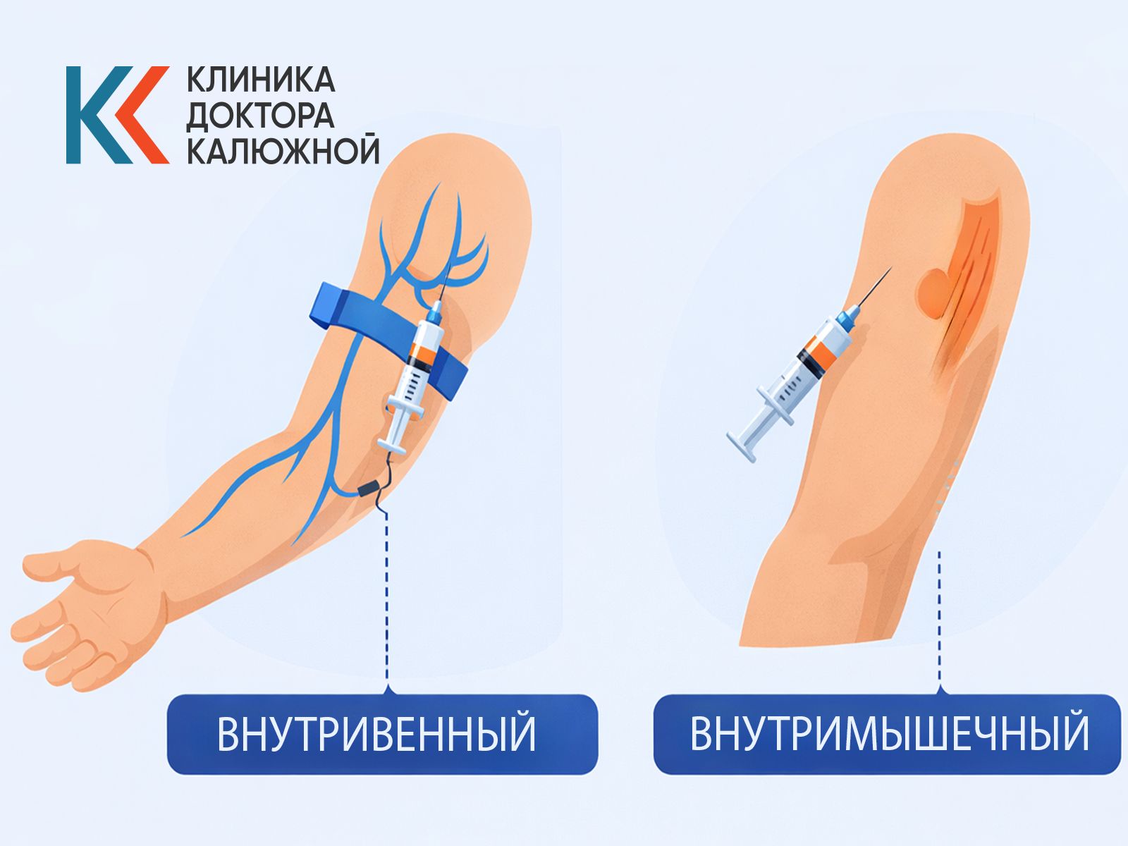 Инфографика, показывающая внутривенный и внутримышечный способы введения препарата для защиты от срывов.